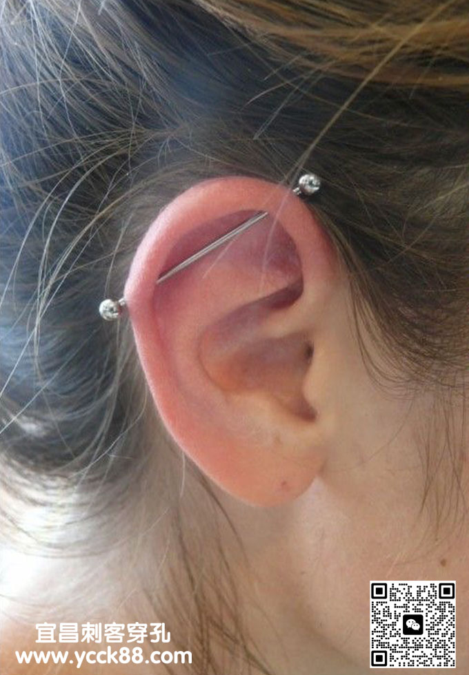 ��������1