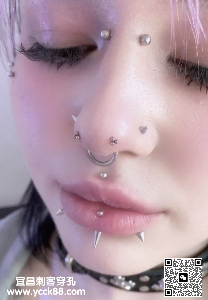 ��������1