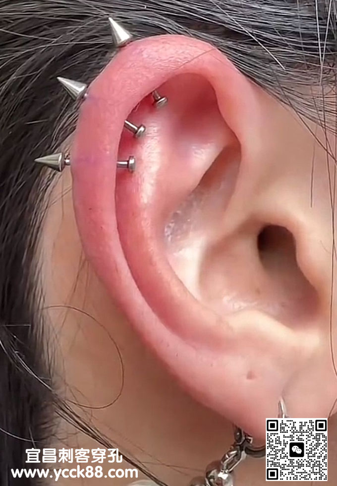 ��������5